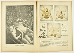 Fritz Kahn: „Ich bin ja so nervös!“; aus: UHU 6 (1929/30), Heft 12 (Foto: Alois Unterkircher)